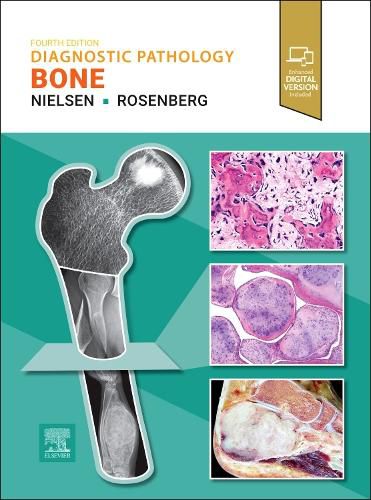 Cover image for Diagnostic Pathology: Bone