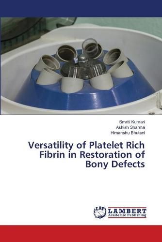 Cover image for Versatility of Platelet Rich Fibrin in Restoration of Bony Defects