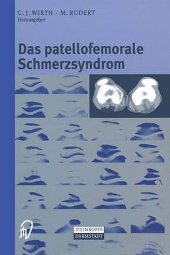 Cover image for Das Patellofemorale Schmerzsyndrom