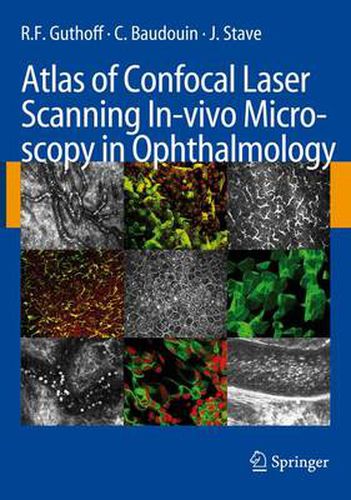 Cover image for Atlas of Confocal Laser Scanning In-vivo Microscopy in Ophthalmology