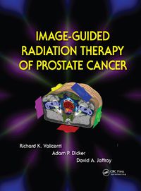 Cover image for Image-Guided Radiation Therapy of Prostate Cancer