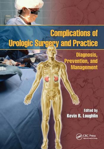 Cover image for Complications of Urologic Surgery and Practice: Diagnosis, Prevention, and Management