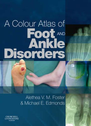 Cover image for A Colour Atlas of Foot and Ankle Disorders