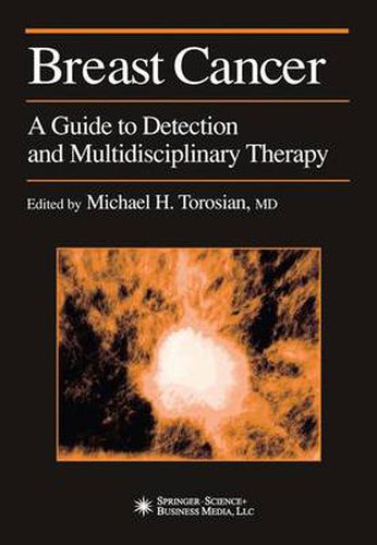 Cover image for Breast Cancer: A Guide to Detection and Multidisciplinary Therapy