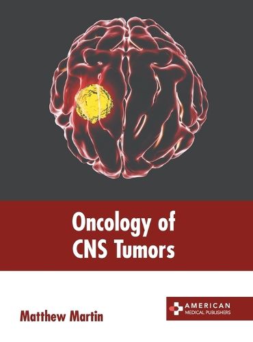 Cover image for Oncology of CNS Tumors