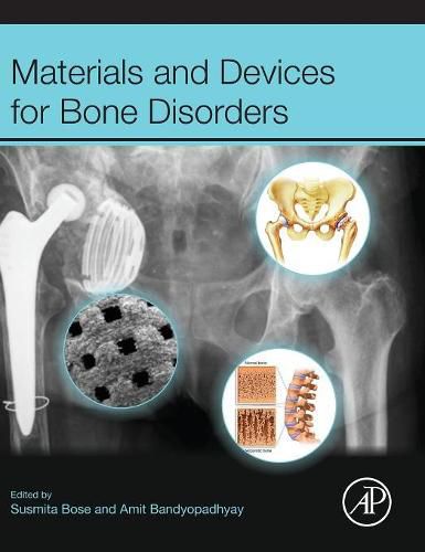 Cover image for Materials and Devices for Bone Disorders