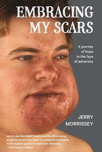 Cover image for Embracing My Scars