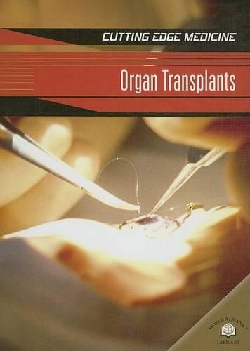 Cover image for Organ Transplants