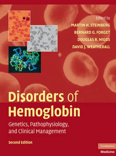 Disorders of Hemoglobin: Genetics, Pathophysiology, and Clinical Management