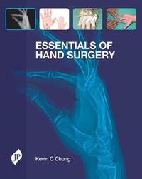 Cover image for Essentials of Hand Surgery