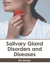 Cover image for Salivary Gland Disorders and Diseases