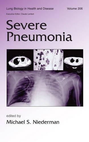 Cover image for Severe Pneumonia