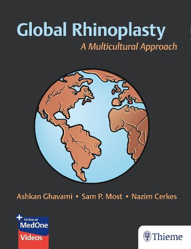 Cover image for Global Rhinoplasty