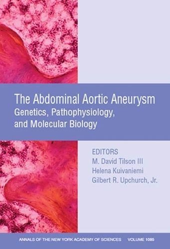 The Abdominal Aortic Aneurysm: Genetics, Pathophysiology, and Molecular ...