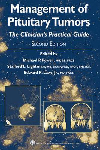 Management of Pituitary Tumors: The Clinician's Practical Guide