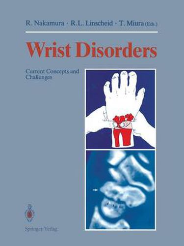 Cover image for Wrist Disorders: Current Concepts and Challenges