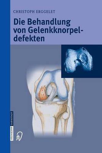 Cover image for Die Behandlung Von Gelenkknorpeldefekten