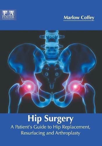 Cover image for Hip Surgery: A Patient's Guide to Hip Replacement, Resurfacing and Arthroplasty