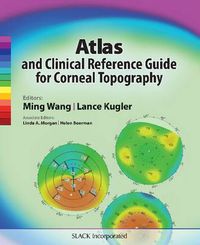 Cover image for Atlas and Clinical Reference Guide for Corneal Topography