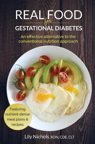 Cover image for Real Food for Gestational Diabetes: An Effective Alternative to the Conventional Nutrition Approach