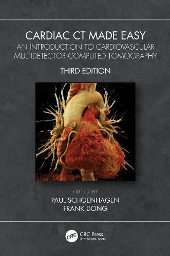 Cover image for Cardiac CT Made Easy: An Introduction to Cardiovascular Multidetector Computed Tomography