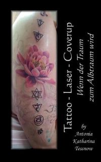 Cover image for Tattoo - Laser - Cover Up: Wenn der Traum zum Albtraum wird