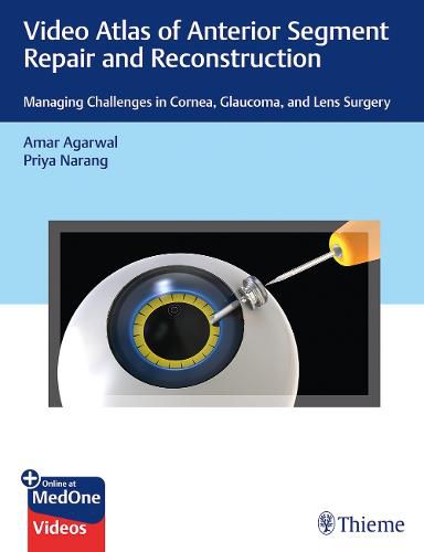 Cover image for Video Atlas of Anterior Segment Repair and Reconstruction: Managing Challenges in Cornea, Glaucoma, and Lens Surgery