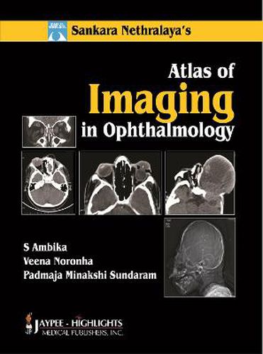 Cover image for Atlas of Imaging in Ophthalmology