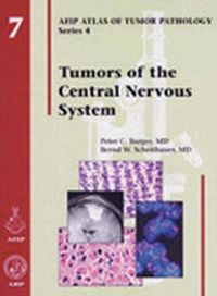 Cover image for Tumors of the Central Nervous System