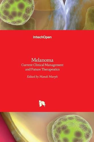 Cover image for Melanoma: Current Clinical Management and Future Therapeutics