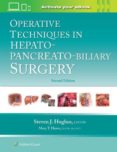 Cover image for Operative Techniques in Hepato-Pancreato-Biliary Surgery