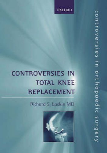 Cover image for Controversies in Total Knee Replacement