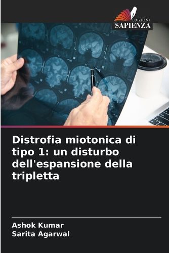 Cover image for Distrofia miotonica di tipo 1