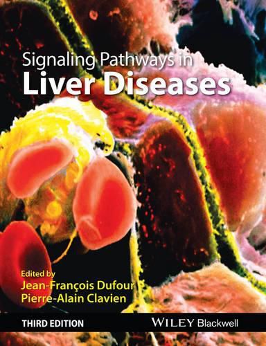 Cover image for Signaling Pathways in Liver Diseases