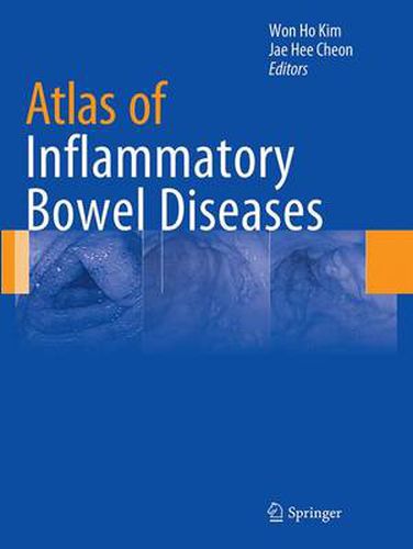 Cover image for Atlas of Inflammatory Bowel Diseases