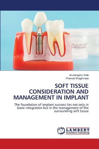 Cover image for Soft Tissue Consideration and Management in Implant
