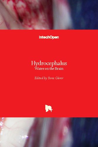 Cover image for Hydrocephalus: Water on the Brain