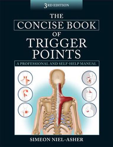 Cover image for The Concise Book of Trigger Points