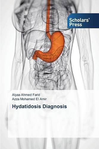 Hydatidosis Diagnosis