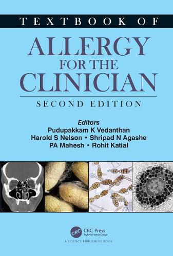 Cover image for Textbook of Allergy for the Clinician