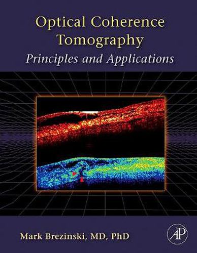 Cover image for Optical Coherence Tomography: Principles and Applications