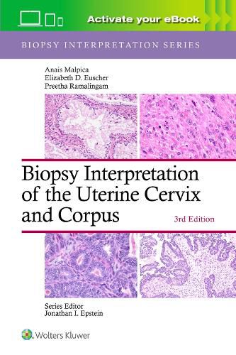 Cover image for Biopsy Interpretation of the Uterine Cervix and Corpus: Print + eBook with Multimedia