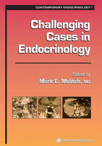 Cover image for Challenging Cases in Endocrinology