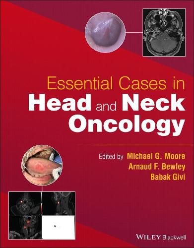 Cover image for Essential Cases in Head and Neck Oncology