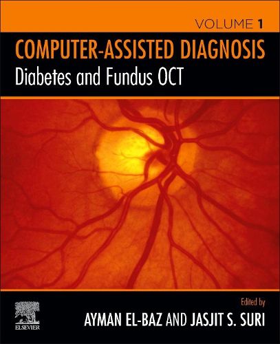 Cover image for Diabetes and Fundus OCT