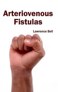 Cover image for Arteriovenous Fistulas