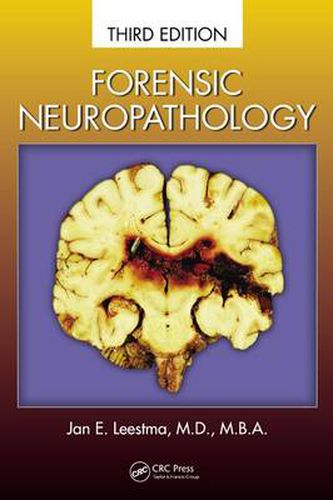 Cover image for Forensic Neuropathology