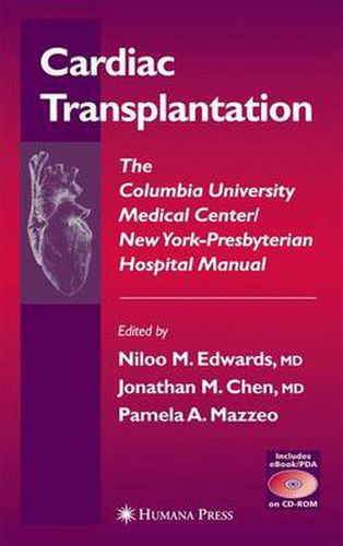 Cover image for Cardiac Transplantation: The Columbia University Medical Center/New York-Presbyterian Hospital Manual