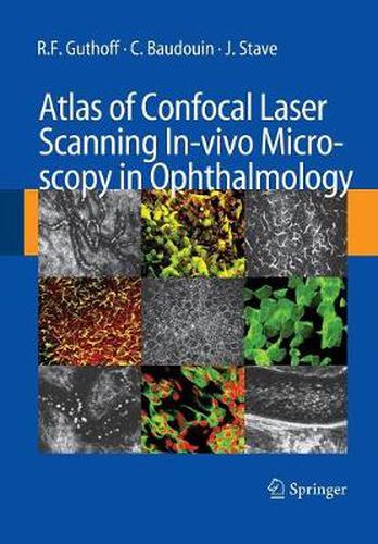 Cover image for Atlas of Confocal Laser Scanning In-vivo Microscopy in Ophthalmology