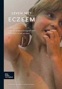 Cover image for Leven Met Eczeem